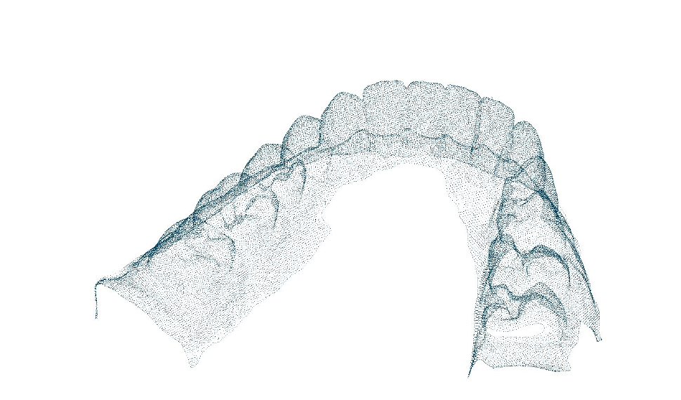 Teeth pointcloud