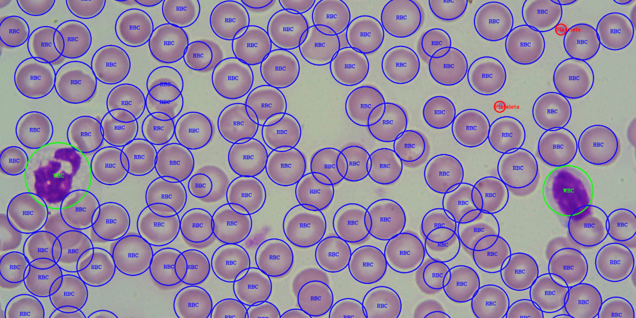Automatic-Identification-and-Counting-of-Blood-Cells