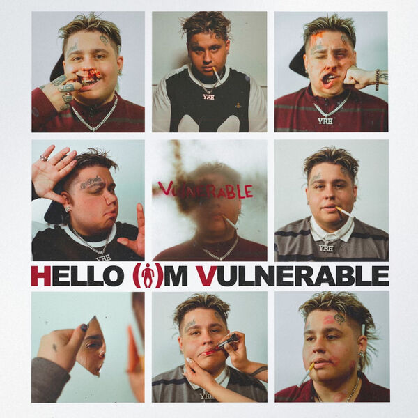 Fat Nick|HELLO I'M VULNERABLE