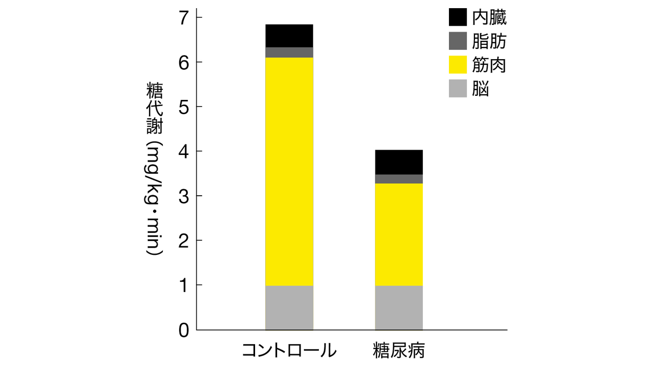 糖尿病患者は筋肉で消費される糖質量が少ない