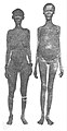 Khoikhoi women with enlarged labia