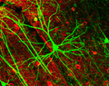 Neurone pyramidal visualisé grâce à la protéine fluorescente verte.