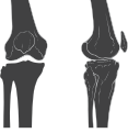 Visão anterior e lateral do esqueleto do joelho.
