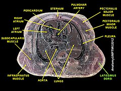 Latissimus dorsi