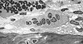 Csontfaló sejt (osteoclast): többmagvú óriássejt