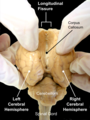 The sheep brain seen from the back. Opening longitudinal fissure which separates left and right cerebral hemispheres.