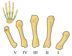 Pět záprstních (metakarpálních) kůstek levé ruky, označených římskými čísly I. až V.