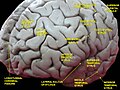 Storhjernen sett framifrå og frå sida. Djup disseksjon.