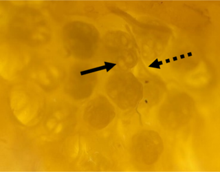 Vergrößerte Aufnahme (40x) von einem Cluster Lorenzinischer Ampullen des Dornhais (Squalus acanthias); zu erkennen sind zahlreiche Endampullen mit ihren bläschenförmigen Aussackungen, den Alveolen (durchgezogener Pfeil), sowie die Bündel afferenter Nervenfasern, die zu den Zentren jeder Ampulle ziehen (gestrichelter Pfeil). (Foto: Simon Bauerle)