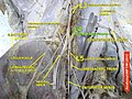 Lumbar spinal nerve 4