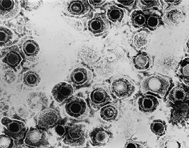 Herpes-simplexvirus