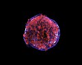 Tycho Supernova remanente en Rayos-X.