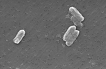 Bakterioj Cytrobacter freundii sub elektrona mikroskopo