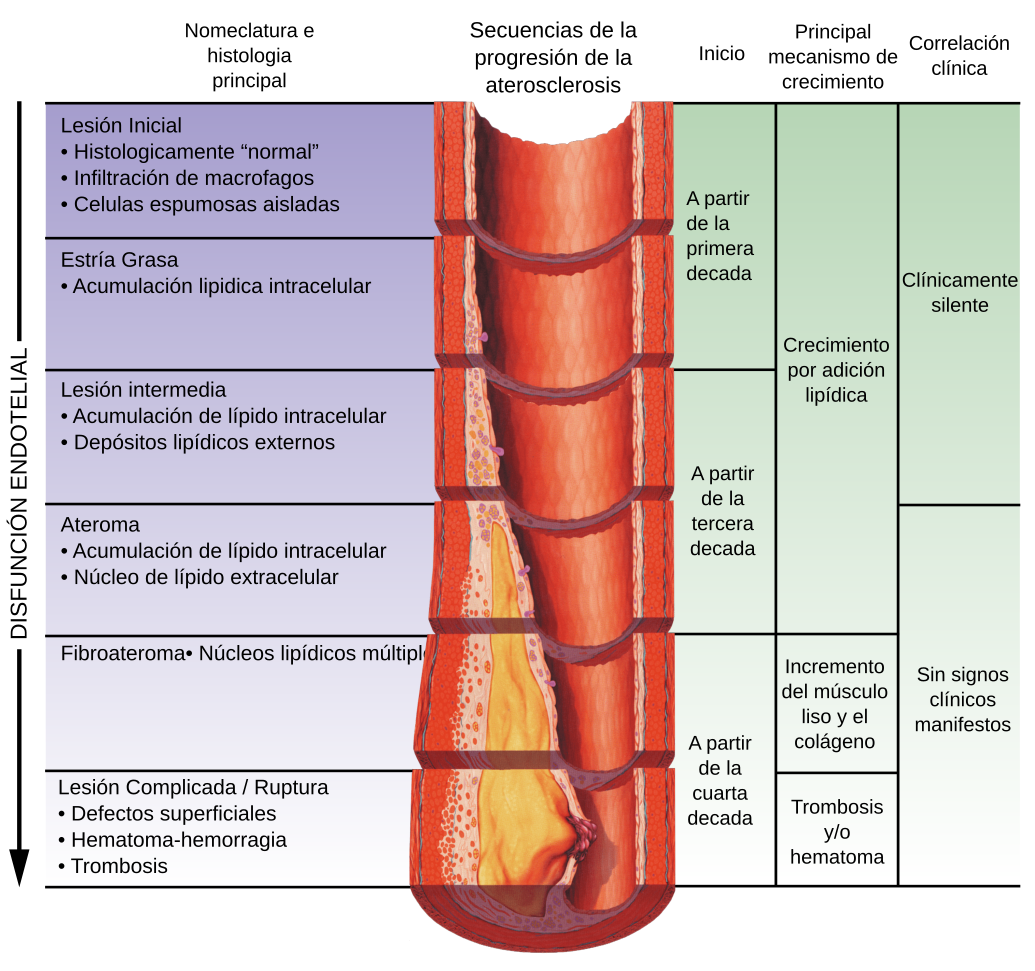 Atherosclerosis timeline - endothelial dysfunction-esp v1.1
