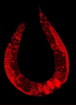 На цьому зображенні, дикий тип Caenorhabditis elegans забарвлена, щоб виділити ядра клітин.