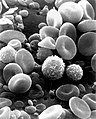 Imagen de microscopía electrónica de barrido correspondiente a sangre circulante normal.