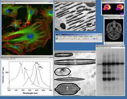 varie schermate di plugin diversi di ImageJ per la microscopia, in esecuzione.