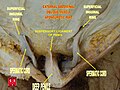 Dissection of the penis and its surroundings.