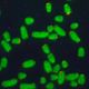 Image de chromosomes en vert au microscope