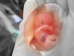 feto humano de diez semanas. Abortado terapeúticamente