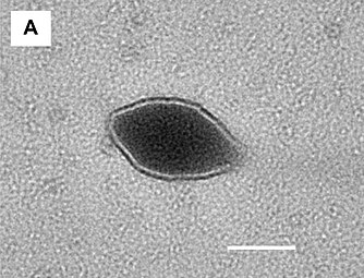 Sulfolobus tailed spindle-shaped virus 3 (STSV3), TEM-Aufnahme