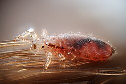 Chawa wa kichwa (Pediculus humanus capitis)