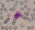 Imagen tomada con un microscopio óptico en la que se observa un monocito típico, su núcleo irregular y lobulado, con cromatina reticulada y citoplasma vacuolado. Tinción de May Grünwald-Giemsa.