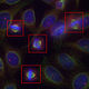 Modalités recalées en fausses couleurs de cellules en mitose au microscope