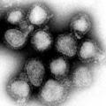 Negative makulita gripo-viruso. Ĉi tiu estis la kaŭzagento de la pandemio de Honkonga gripo.