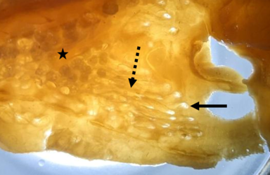 Rückseite eines Hautstücks von der ventralen Kopfseite des Dornhais (Squalus acanthias), neben der Nasenöffnung; zu erkennen sind die Poren der Lorenzinischen Ampullen (durchgezogener Pfeil), die Ampullengänge (gestrichelter Pfeil) und die Endampullen (Stern), bestehend aus vielen kleinen Alveolen. (Foto: Simon Bauerle)