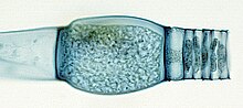 "Oedogonium" sp., showing an oogonium (swollen cell) and antheridia (short stacked cells)