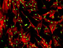 HeLa-cellen. Het cytoskelet is rood gekleurd. Kernen fluoresceren groen.