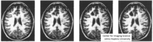 Illustration of changing both gray levels in an imaging which is classical warping from Michael Jackson video as well as diffeomorphic orbit transformation.,