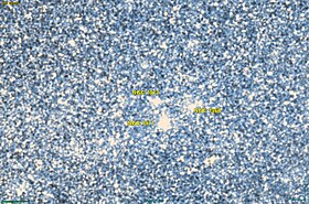 Image illustrative de l’article NGC 1972