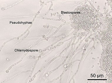 Chlamydospores of the yeast Candida albicans