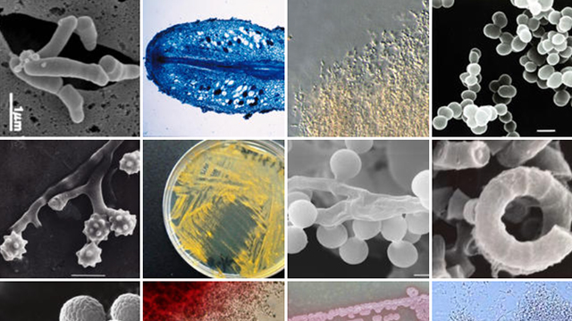 Digital Atlas of Actinomycetes Ver.2