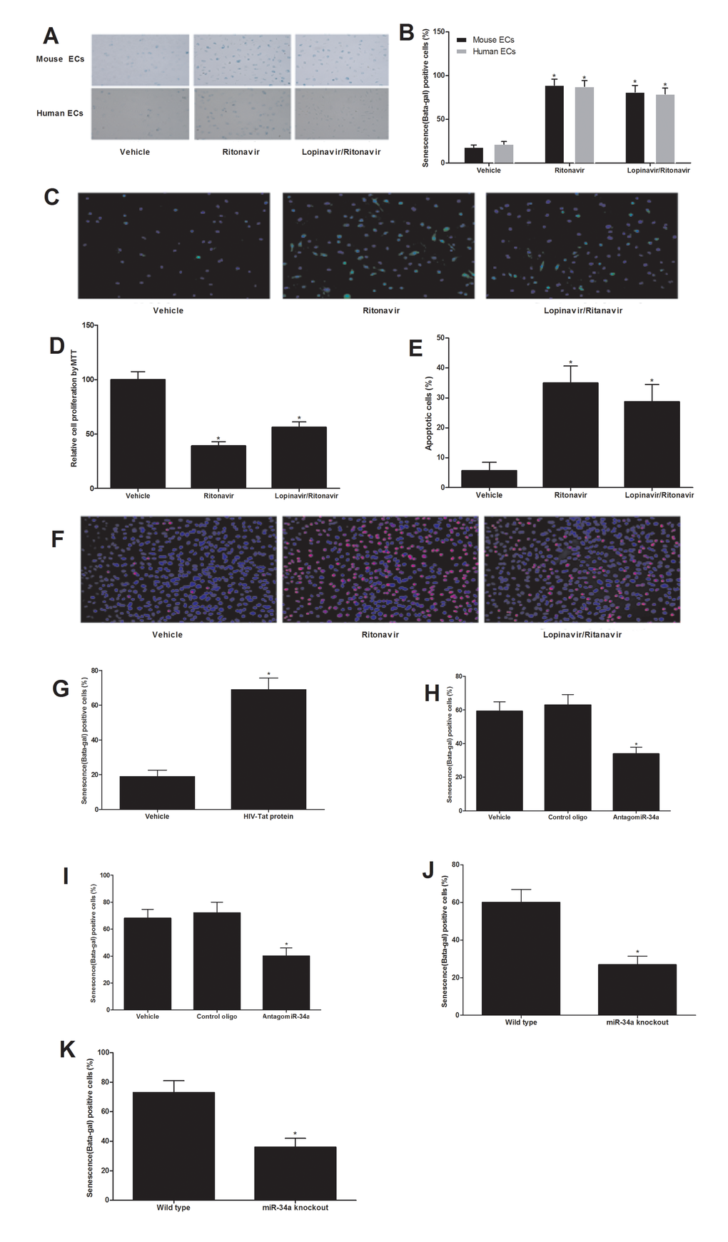 Both antiretroviral agents and HIV-Tat protein induce senescence of ECs, which could be inhibited by miR-34a knockdown or miR-34a knockout. Antiretroviral agents ritonavir (7.5 Âµmol/L), or lopinavir (10 Âµmol/L) plus ritonavir (2 Âµmol/L) (lopinavir/ritonavir) could induce EC senescence as shown by the increased beta-gal staining (A and B), increased ROS production (C), decreased EC proliferation (D) and increased apoptosis induced by H2O2 (100 ÂµM) (E and F). EC senescence was enhanced by HIV-Tat protein (100 nM) as shown by the increased beta-gal staining (G). Both antiretroviral agents (H) and HIV-Tat protein (I) induced senescence of ECs could be inhibited by miR-34a knockdown AntagomiR-34a (30 nM). The ECs from miR-34a knockout mice were resistant to antiretroviral agents (J) and HIV-Tat protein (K) induced senescence of ECs. Note: n=6; *p