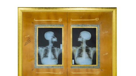 An artwork showing a double X-ray of a human skeleton agains a black and gold background.