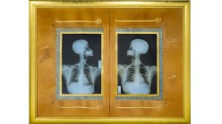 An artwork showing a double X-ray of a human skeleton agains a black and gold background.