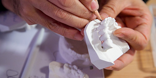 Individual marking out in pencil on plaster model of jaw.