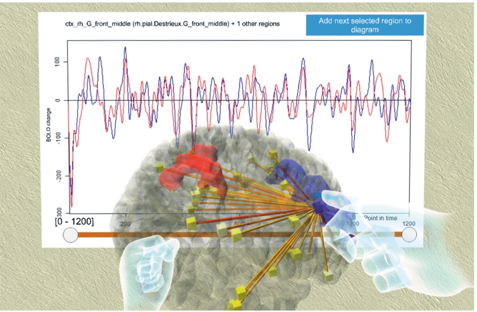 Figure 7 
Brain data analytics – a brain model that allows to distinguish anatomical regions is combined with brain activity data. The activity data acquisition provides time series that can be depicted in a classical chart, but also turned into a network by correlation analysis, which allows to map activity correlations between regions into the 3D model. Interaction allows to rotate the model and to select regions for in-depth analysis of their activity and correlations. Taken from [39], © 2019 IEEE.
