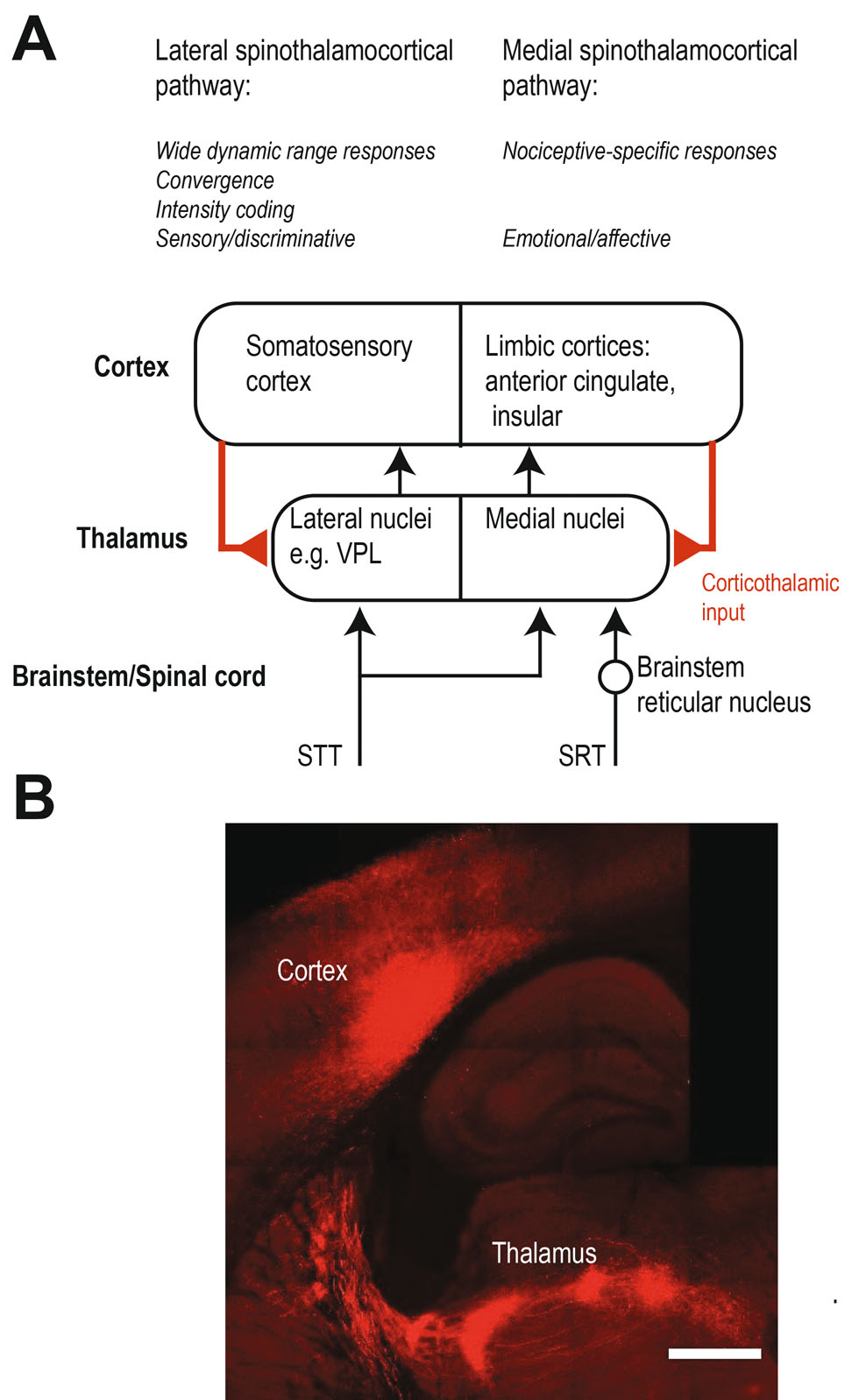 Fig. 1 Pain associated spinothalamocortical pathways.ASchematic summarizing and contrasting the lateral and medial thalamic pain pathways. For simplicity, descending pathways are shown simplified and are confined to corticothalamic feedbackwithineach pathway. Other descending projections to the midbrain, brainstem and spinal cord as well as inhibitory connections are not shown.BCorticothalamic projections are modulating sensory signals in the thalamus including putative pain signals. Cortical projections from cortical layer 5 provide a strong excitatory “driver” input whereas projections from cortical layer 6 are believed to be weaker and rather have a “modulatory” function. The corticothalamic axonal projections can be visualized using viral technologies (adeno-associated virus encoding the fluorophore mCherry). The axons in this example innervate various nuclei in the lateral thalamus. Scale bar is 500 µm.