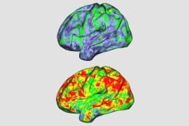 brain_stable-activity_before_after_magic-mushrooms-psilocybin_WUSTL_1m.jpg