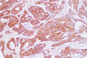 IHC Related Reagents