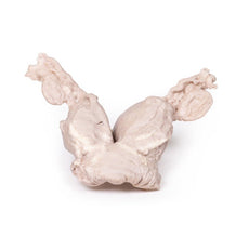 3D Printed Uterus Bicornuate Unicollis