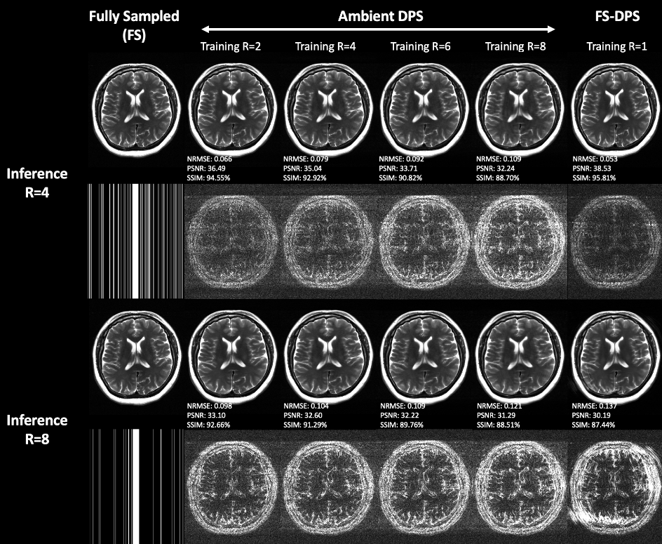 ambient_mri.png 