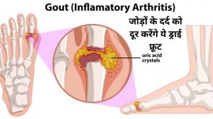 uric acid, uric acid kya hota hai, uric acid foods to avoid, uric acid foods to avoid in hindi, uric acid foods, worst food for uric acid, uric acid kya hota hai hindi mein