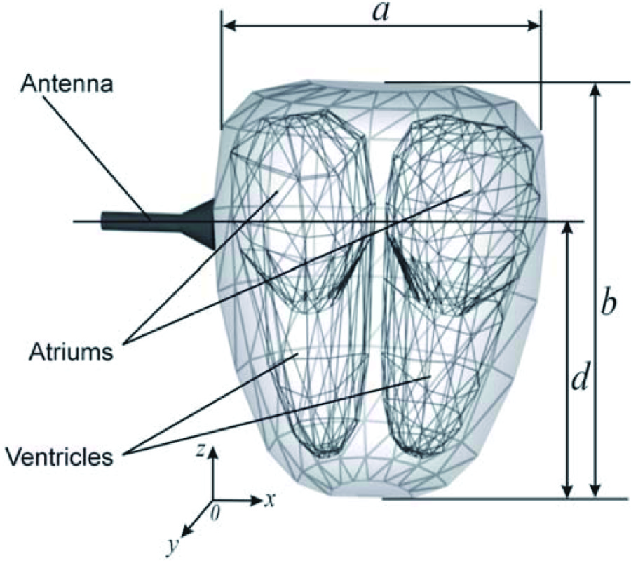 SINGULAR INTEGRAL METHOD FOR THE PULSE-MODULATED MICROWAVE ELECTRIC FIELD COMPUTATIONS IN A 3D HEART MODEL