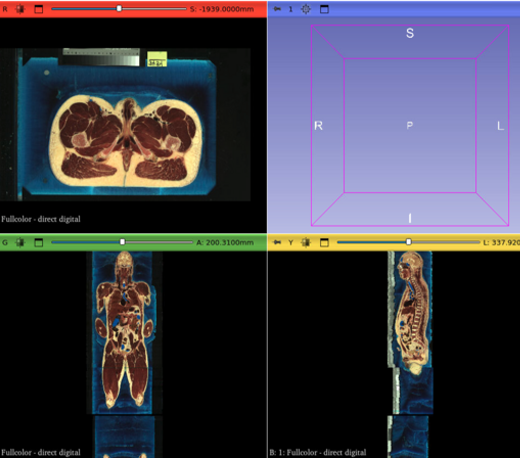 DICOM images from ITK