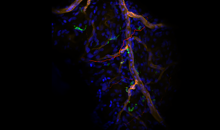 cardiac MP, nerve, EC